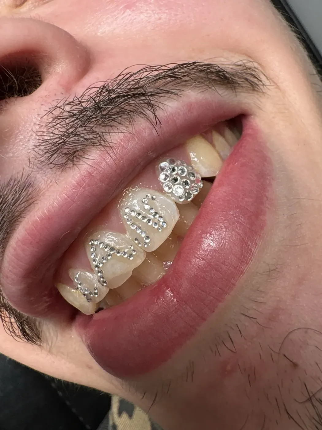 Dent entièrement pavée de strass, vue de profil