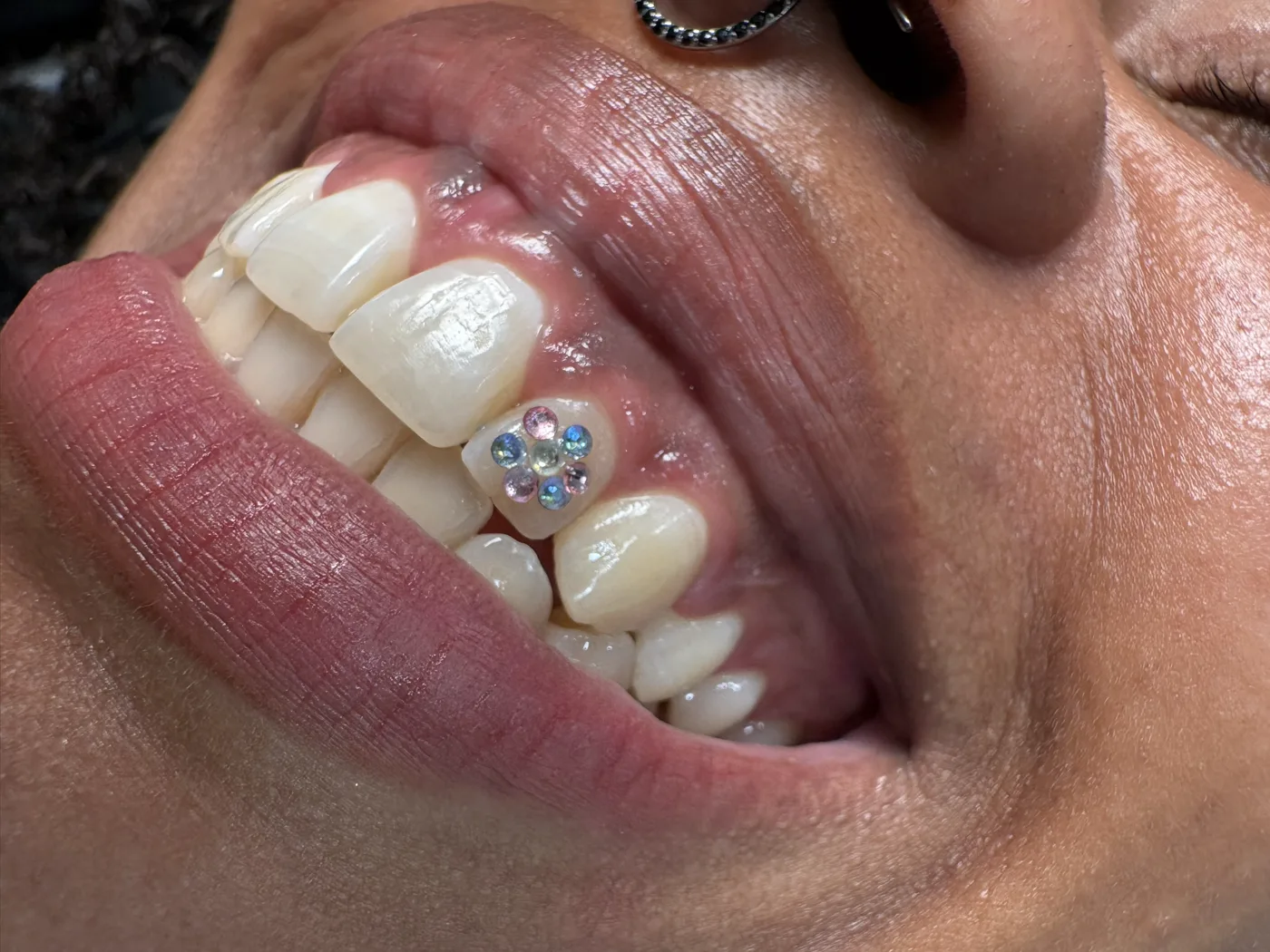 Fleur en strass irisés sur une incisive