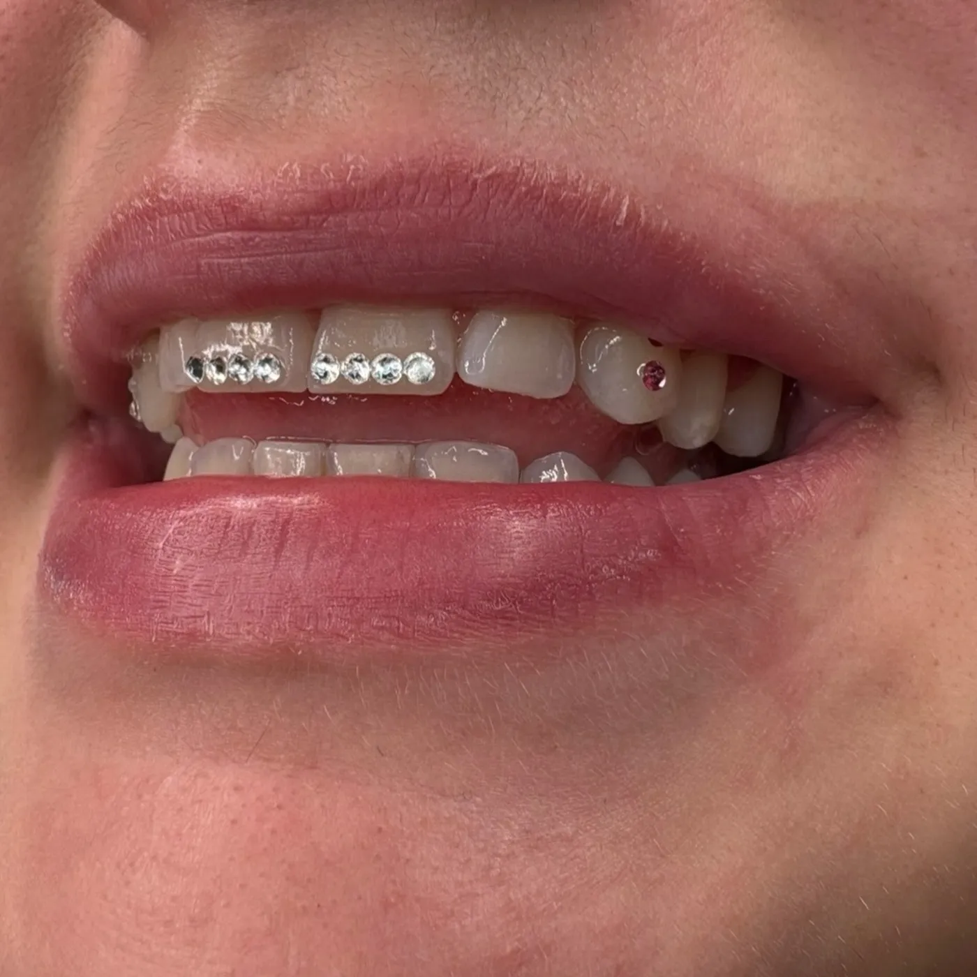 Ligne de strass sur quatre dents du haut